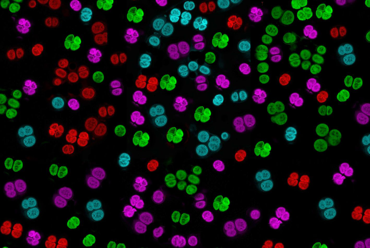NRMC-F NRMC-F